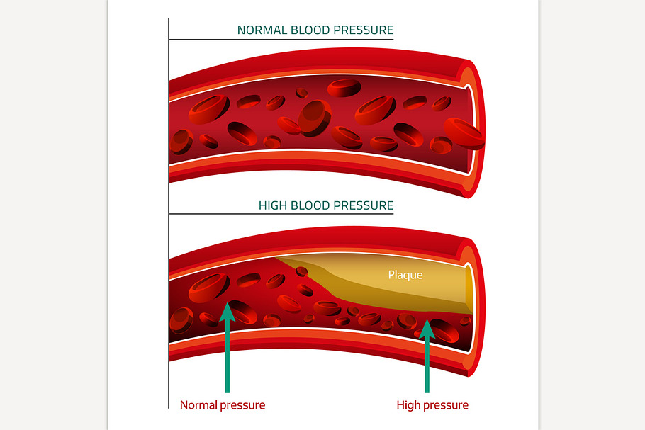 Blood Pressure Infographic in Illustrations - product preview 8