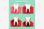 Teeth Infographic