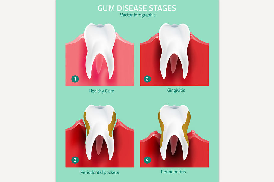 Teeth Infographic in Illustrations - product preview 8