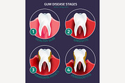 Teeth Vector Infographic