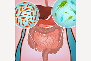 Intestinal Infection Image