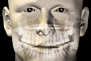 Male Dental Scan