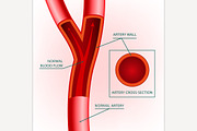 Blood Vein Image