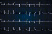 Electrocardiogram graph on dark blue