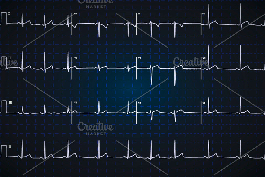 Electrocardiogram graph on dark blue in Illustrations - product preview 8