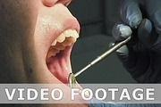 Man gets dentist medical mouth teeth treatment