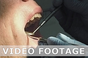Man gets dentist medical mouth teeth examination