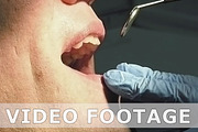 Man gets dentist medical mouth teeth examination