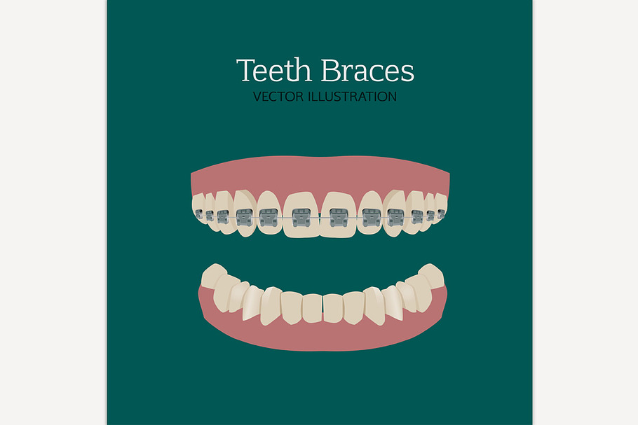 Teeth Braces in Illustrations - product preview 8