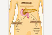 Pancreas and Duodenum