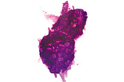 Purple Explosion 