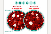 Anemia level of blood cells