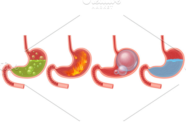Realistic illustration of stomach