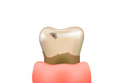 Sick realistic human tooth