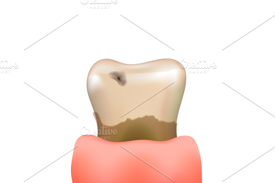 Sick realistic human tooth in Objects - product preview 8