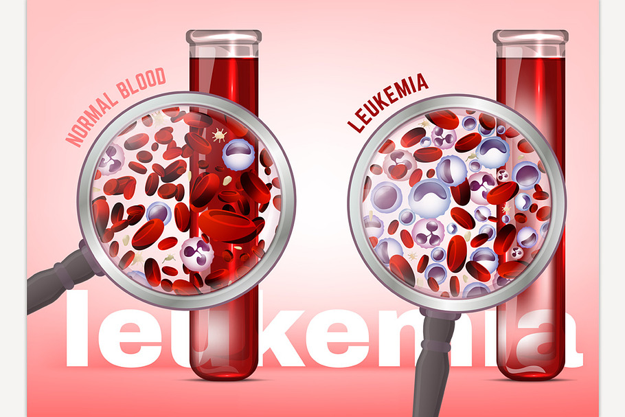 Leukemia horizontal background in Illustrations - product preview 8