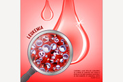 Leukemia vertical background 