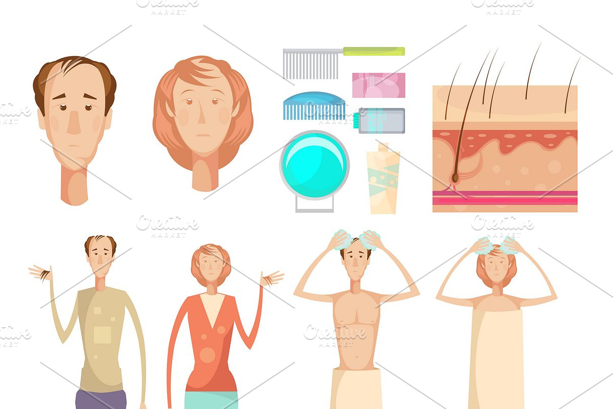 Hair loss infographic elements set in Icons - product preview 8