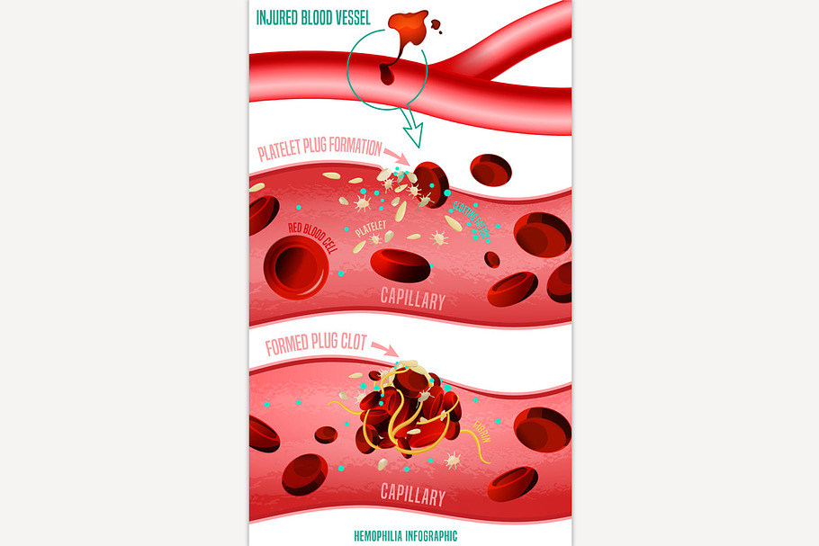 Blood clot formation in Illustrations - product preview 8