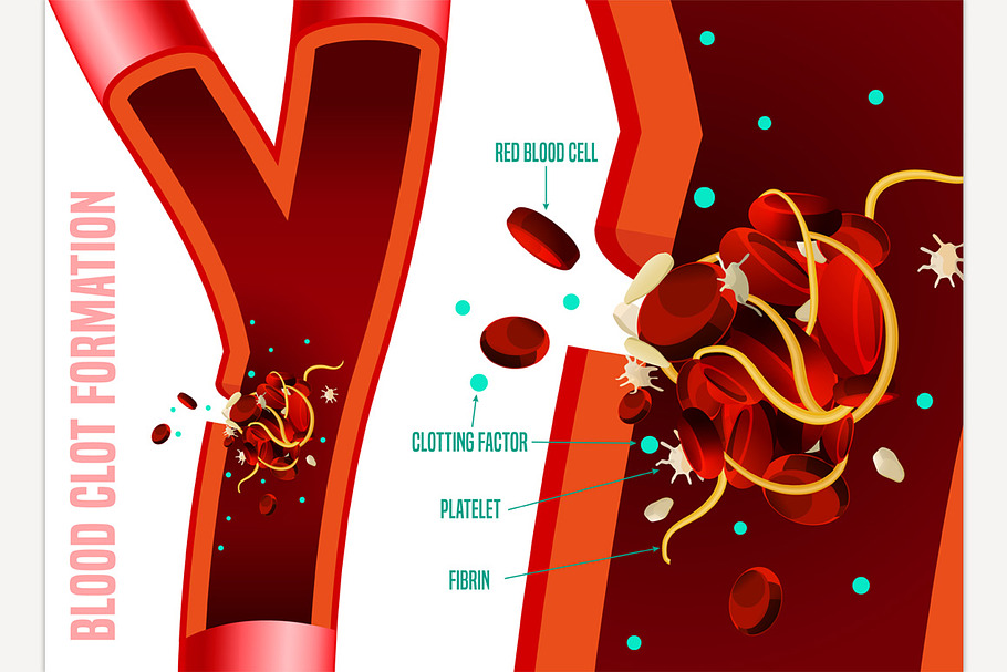 Blood clot formation in Illustrations - product preview 8