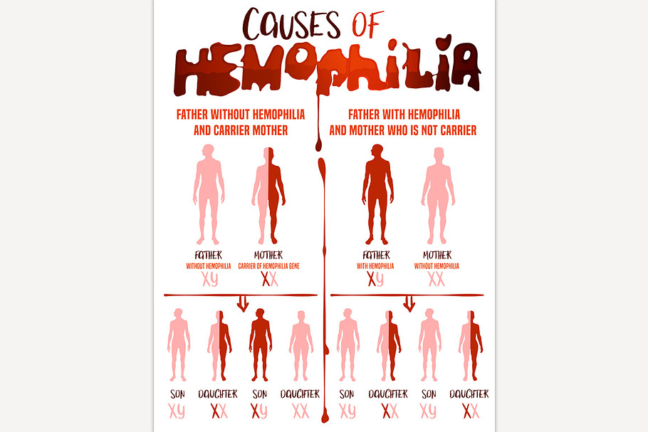 Hemophilia Causes Poster in Illustrations - product preview 8