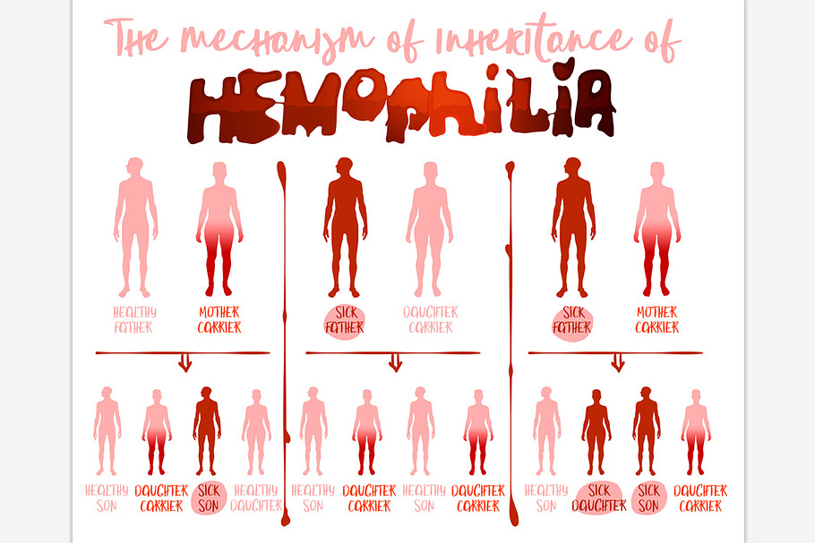 Hemophilia Infographics Image