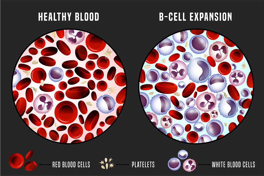 Leukemia Infographic Image in Illustrations - product preview 8