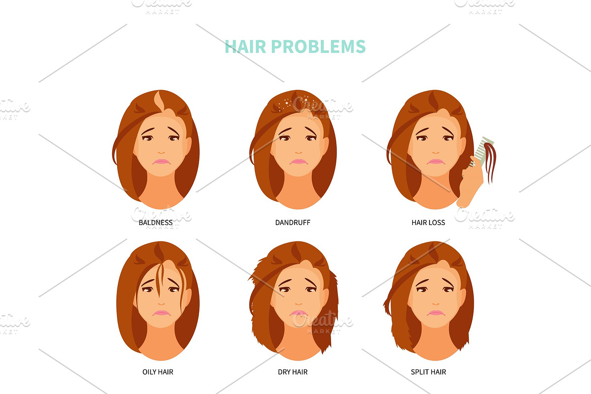 Hair problems vector in Illustrations - product preview 8