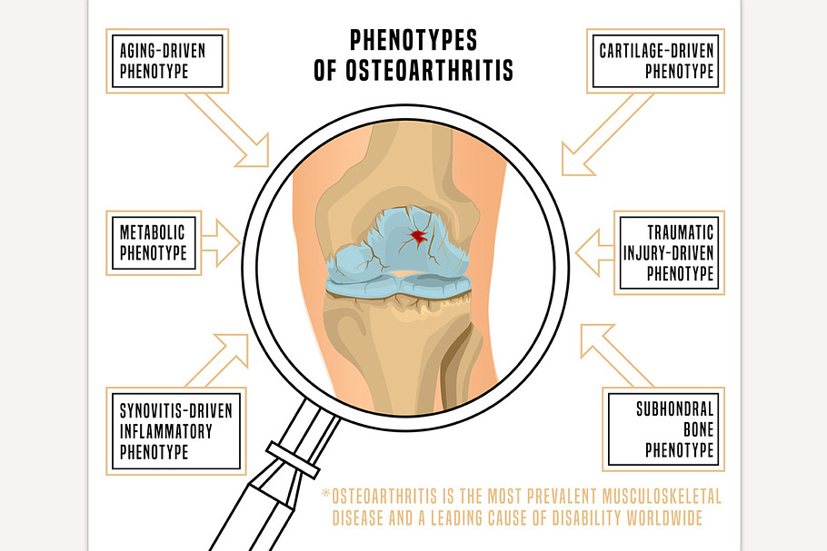 Osteoarthritis Knee Phenotypes