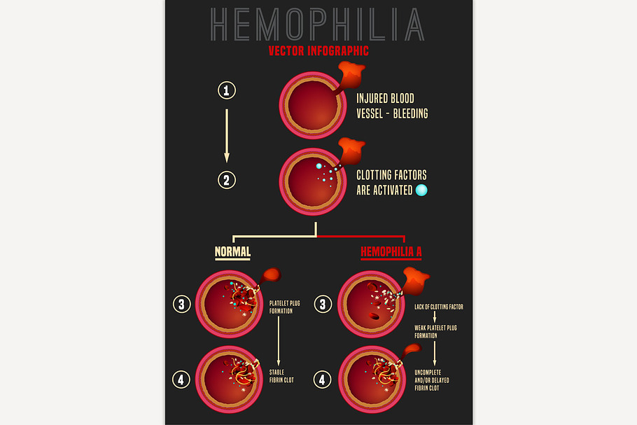Hemophilia Blood Clotting Process in Illustrations - product preview 8