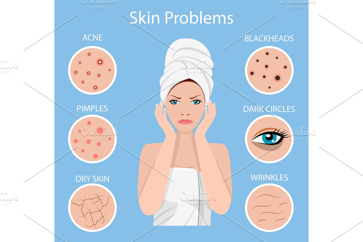 Woman facial skin problems. in Illustrations - product preview 8