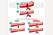 Hemophilia Infographics Poster