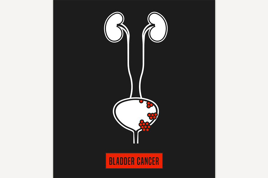 Bladder Cancer Icon in Illustrations - product preview 8