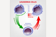 Leukemia medical infographic