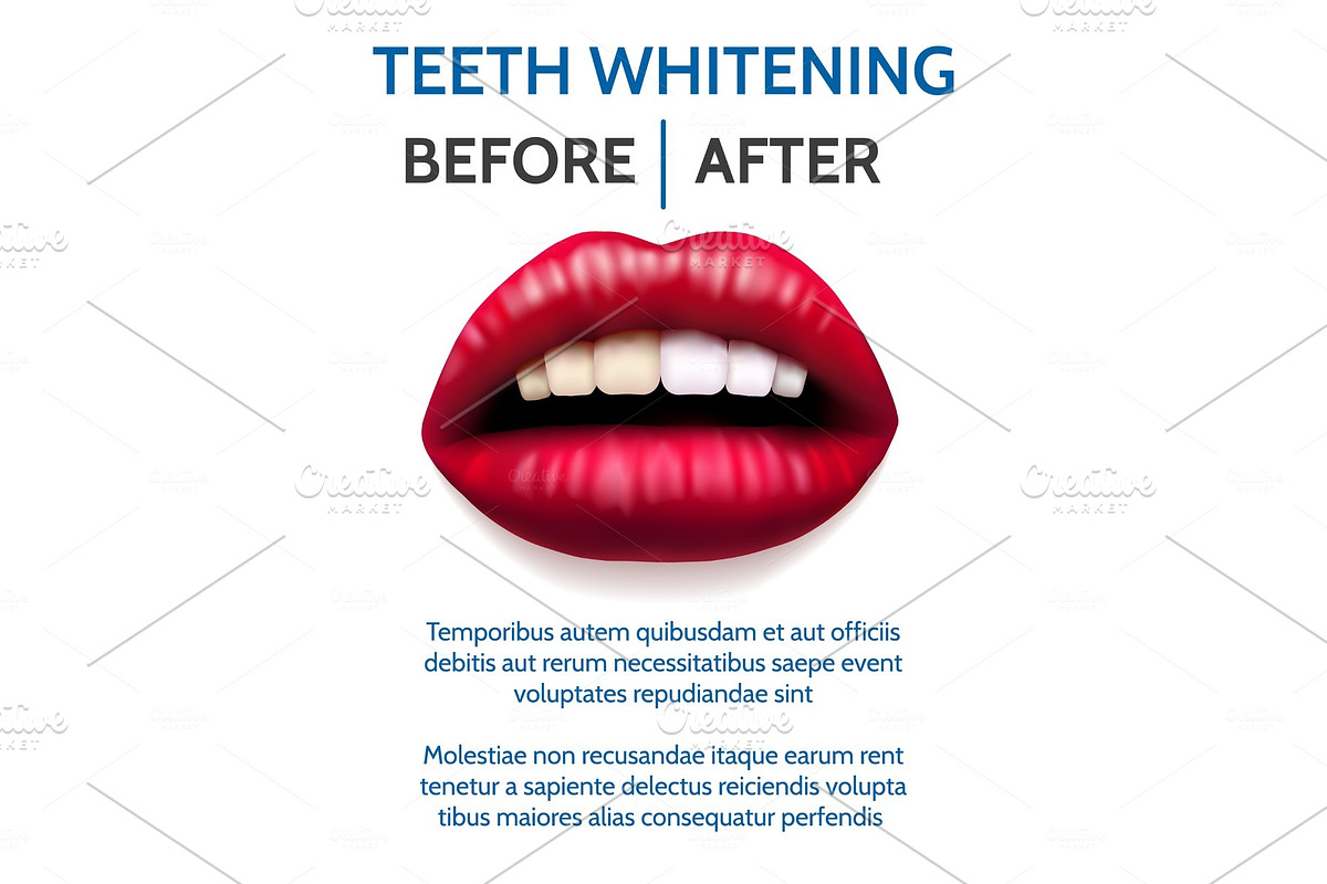 Teeth whitening poster in Objects - product preview 8