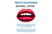 Teeth whitening poster