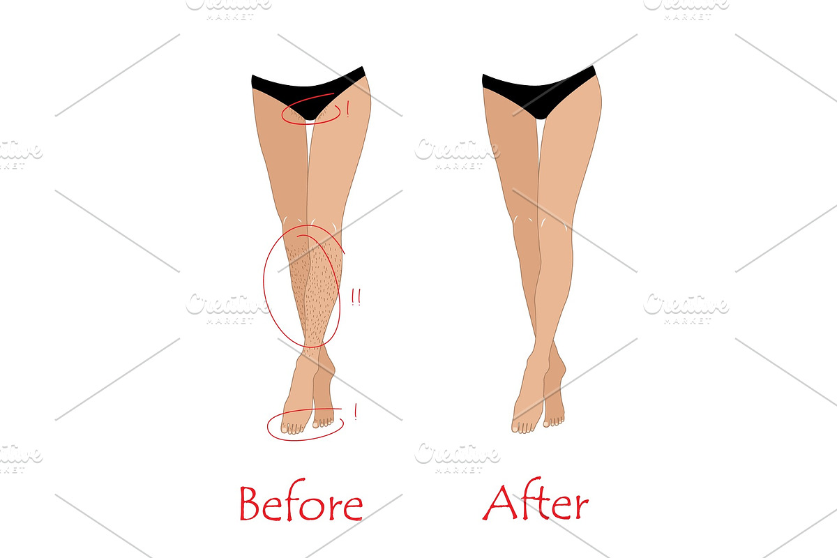 Woman epilation or depilation in Illustrations - product preview 8