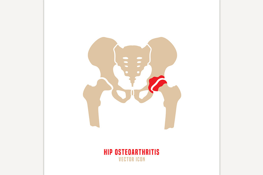 Hip osteoarthritis icon