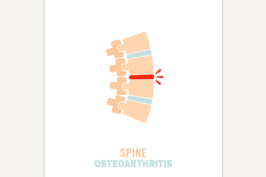 Spine osteoarthritis icon in Icons - product preview 8