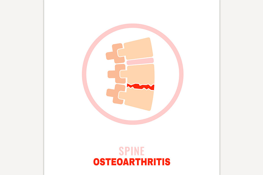 Spine osteoarthritis icon in Icons - product preview 8