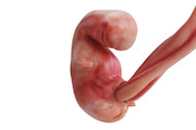 Human embryo fetus unborn