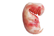 Human embryo fetus unborn, side view