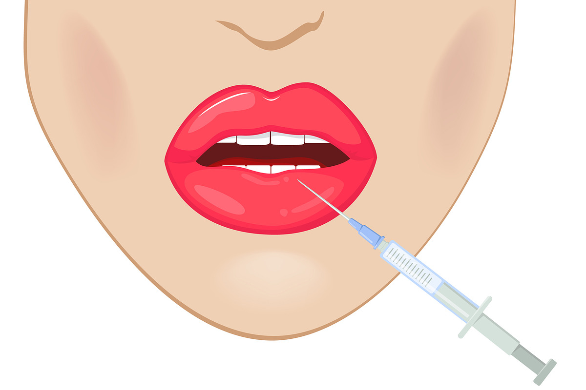 Lips Augmentation in Illustrations - product preview 8