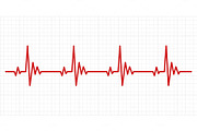 Heartbeat electrocardiogram