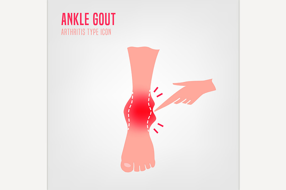 Gout arthritis icon